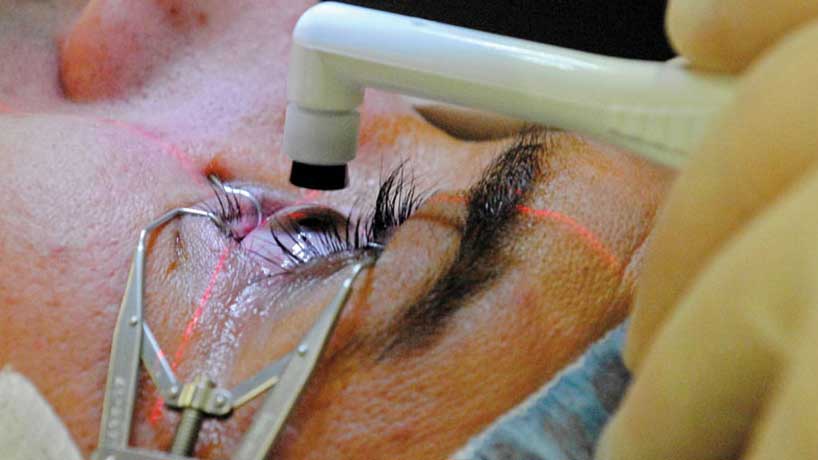 درمان شناورهای چشم
