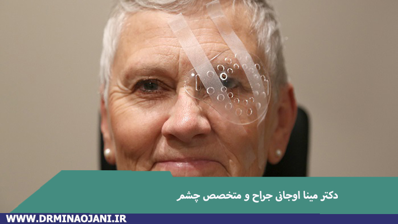 جراحی آب مروارید در تهران