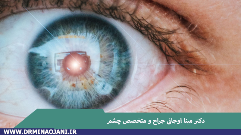 تفاوت های جراحی چشم به روش لیزیک و روش اسمایل چیست؟