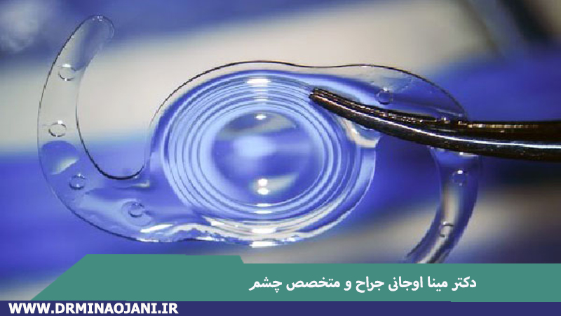 ۳ نوع اصلی کاشت لنز برای جراحی آب مروارید کدام اند؟