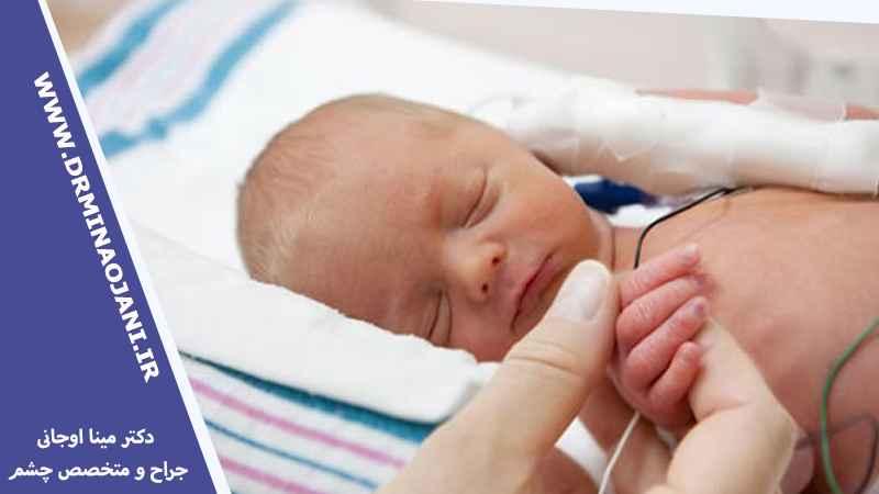 بهترین دکتر فوق تخصص رتینوپاتی نوزادان نارس کرج