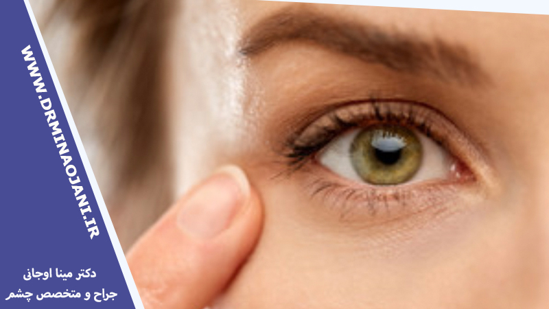 معاینه بینایی در بهترین مرکز فوق تخصص شبکیه کرج