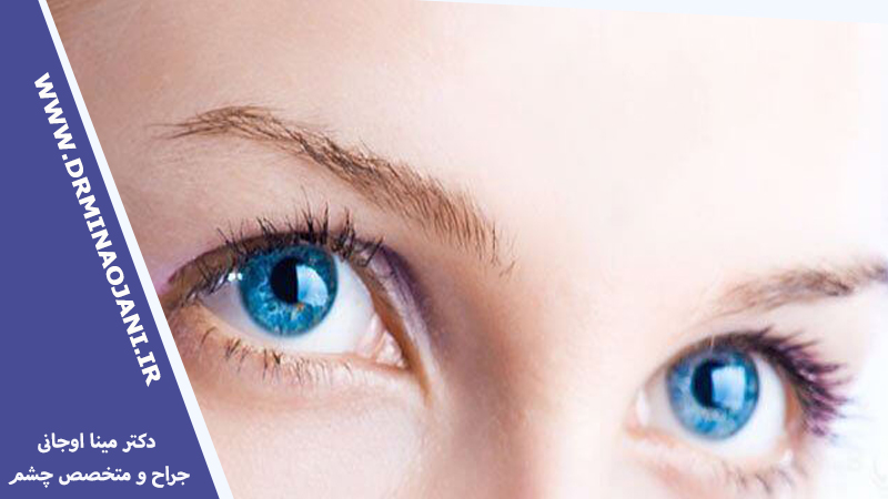 انواع مختلف لیزر چشمی برای عمل لیزیک چشم در کرج