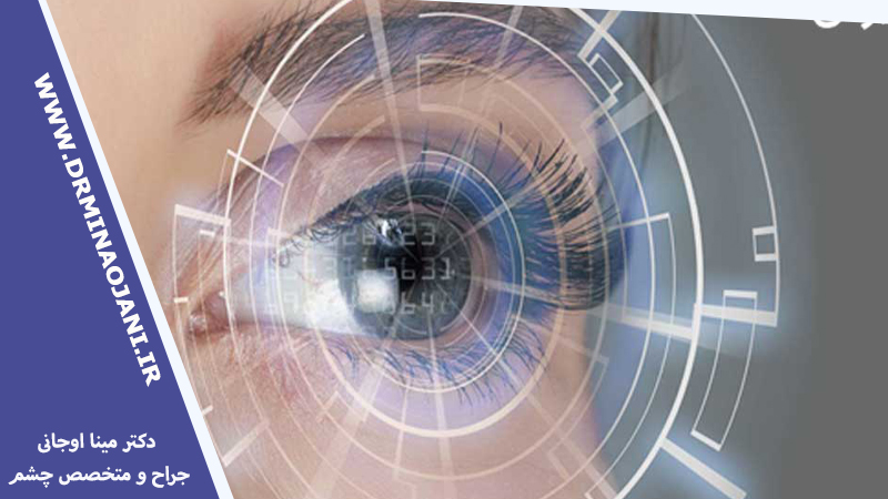 جراحی لیزیک چشم شامل چه مواردی است؟